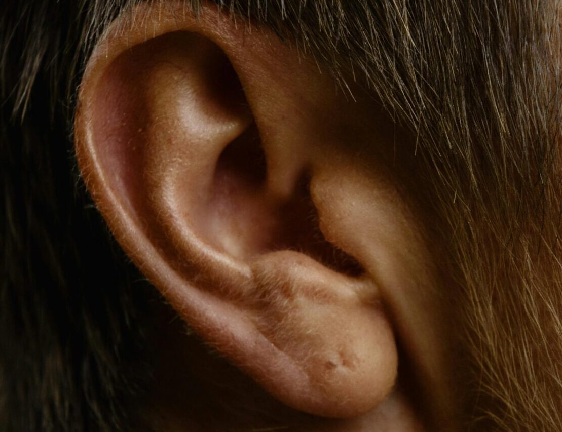 Primer plano de una oreja humana vista de perfil, mostrando detalles de la piel y el cabello circundante.
